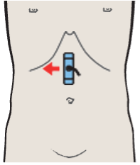 Probe position, Pylorus, pancreas, liver