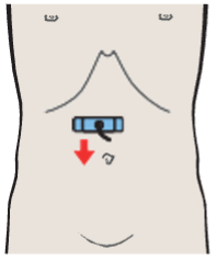 Probe position, Antrum, duodenum, liver, pancreas, gallbladder