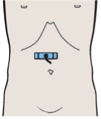 Probe position, Antrum, gallbladder