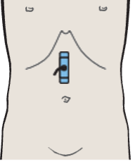 Probe position, Layers of gastric wall