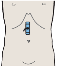 Probe position, Layers of gastric wall