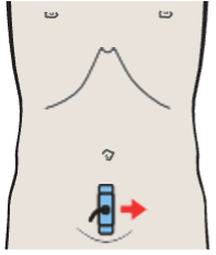 Probe position, Bladder, ureteral orifice, prostate, rectum