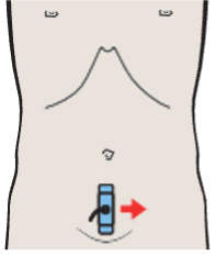 Probe position, Prostate, rectum, bladder