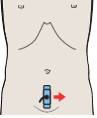 Probe position, Prostate, seminal vesicles