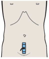 Probe position, Prostate, seminal vesicles