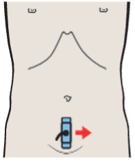 Probe position, Vagina, uterus, bladder