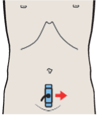 Probe position, Uterus, bladder
