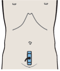 Probe position, Bladder, ovary