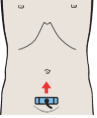 Probe position, Vagina, bladder, rectum
