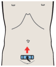 Probe position, Uterus, bladder, rectum