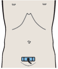 Probe position, Uterus, bladder, rectum, ovaries