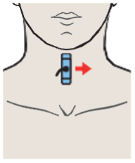 Probe position, Left lobe of thyroid gland, sternohyoid muscle, sternothyroid muscle