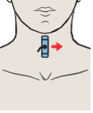 Probe position, Left lobe of thyroid gland, sternohyoid muscle, sternothyroid muscle, internal jugular vein