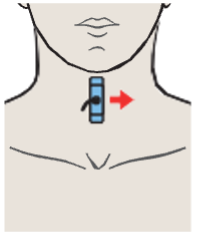 Probe position, Left lobe of thyroid gland, sternocleidomastoid muscle, common carotid artery, internal jugular vein