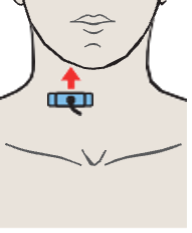Probe position, Right lobe of thyroid gland, sternocleidomastoid muscle, common carotid artery, internal jugular vein