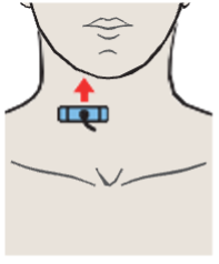 Probe position, Right lobe of thyroid gland, sternocleidomastoid muscle, omohyoid muscle, sternohyoid muscle, common carotid artery, internal jugular vein