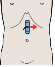 Probe position, Aorta