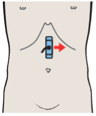 Probe position, Splenic vein and left gastric artery