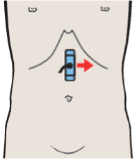 Probe position, Splenic artery and vein, renal artery and vein