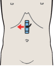 Probe position, Celiac trunk