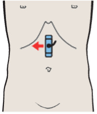 Probe position, Hepatic artery and splenic vein