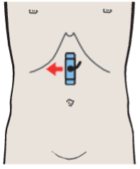 Probe position, Hepatic artery and portal vein