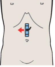 Probe position, Aorta