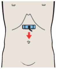 Probe position, Celiac trunk