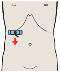 Probe position, Renal vein