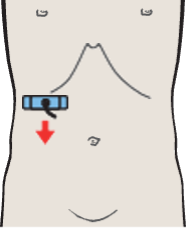 Probe position, Renal vein at hilum, renal artery