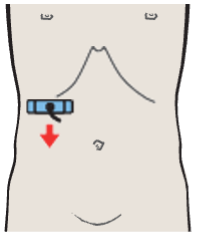 Probe position, Renal artery