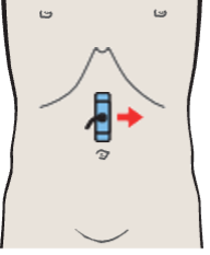 Probe position, Aorta and left renal vein