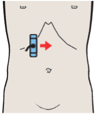 Probe position, Portal vein, vena cava, right renal artery, and bile duct