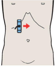 Probe position, Portal vein and hepatic artery