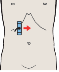 Probe position, Hepatic artery, superior mesenteric vein