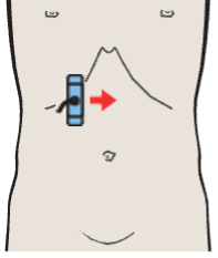 Probe position, Hepatic artery, superior mesenteric artery, and splenic vein