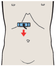 Probe position, Hepatic artery, bile duct, portal vein