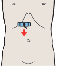 Probe position, Bile duct, gallbladder, superior mesenteric vein