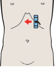 Probe position, Left lobe of liver, lateral segment, subsegments II and III