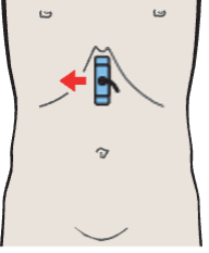 Probe position, Left lobe of liver, ligamentum teres, boundary between lateral and medial segments