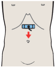 Probe position, Splenic artery