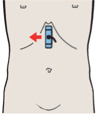Probe position, Left lobe of liver, ligamentum teres, boundary between lateral and medial segments, caudate lobe