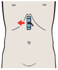 Probe position, Left hepatic vein, ligamentum teres, boundary between lateral and medial segments, caudate lobe