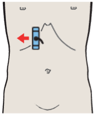 Probe position, Middle hepatic vein, boundary between medial and anterior segments