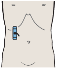 Probe position, Posterior segment, lateral portions of liver, kidney