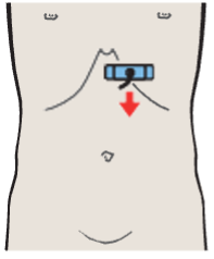 Probe position, Left lobe of liver, lateral segment, heart