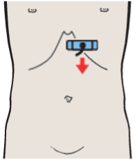 Probe position, Left lobe of liver, lateral segment, caudate lobe