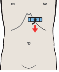Probe position, Left lobe of liver, lateral segment, caudate lobe