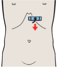 Probe position, Left lobe of liver, lateral segment, left portal vein branch