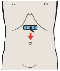 Probe position, Superior mesenteric artery
